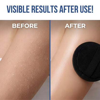 SoftScrub™ Exfoliating Pads